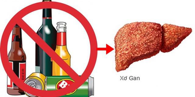 Xơ gan do rượu: những triệu chứng cần lưu ý